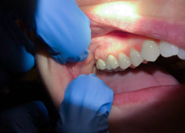 Best Emergency Treatment for Toothache in Gordon Heights, NY